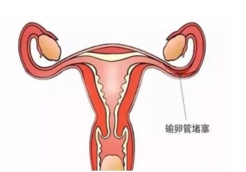 深圳试管助孕公司：2022例假一直不来，这是推迟了还是怀孕了-