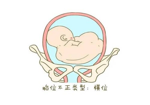 子宫出血多囊后是否影响怀孕？做这些能够有效阻止此病症的发生