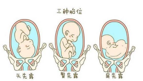 赴美生子：十大优势与父母应考虑的风险解析！
